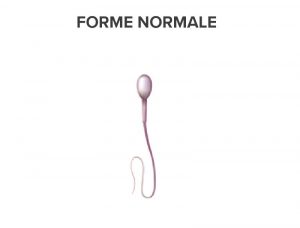 Spermatozoide de forme normale