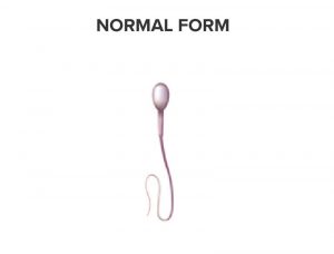 Spermatozoa in a normal form